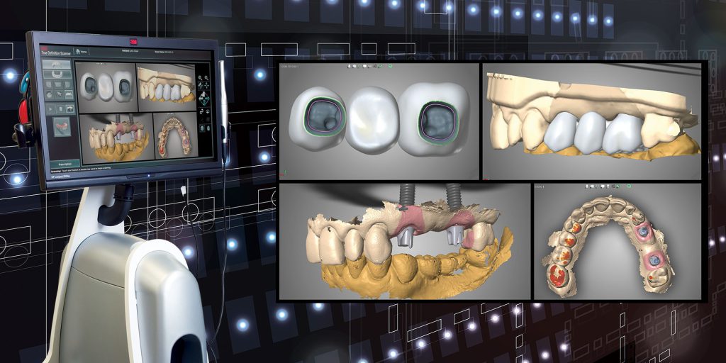 جراحی ایمپلنت دندان دیجیتال چیست و چگونه کار می کند؟